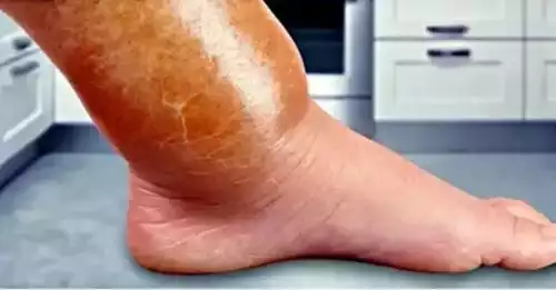 Product image of Lymph MD 